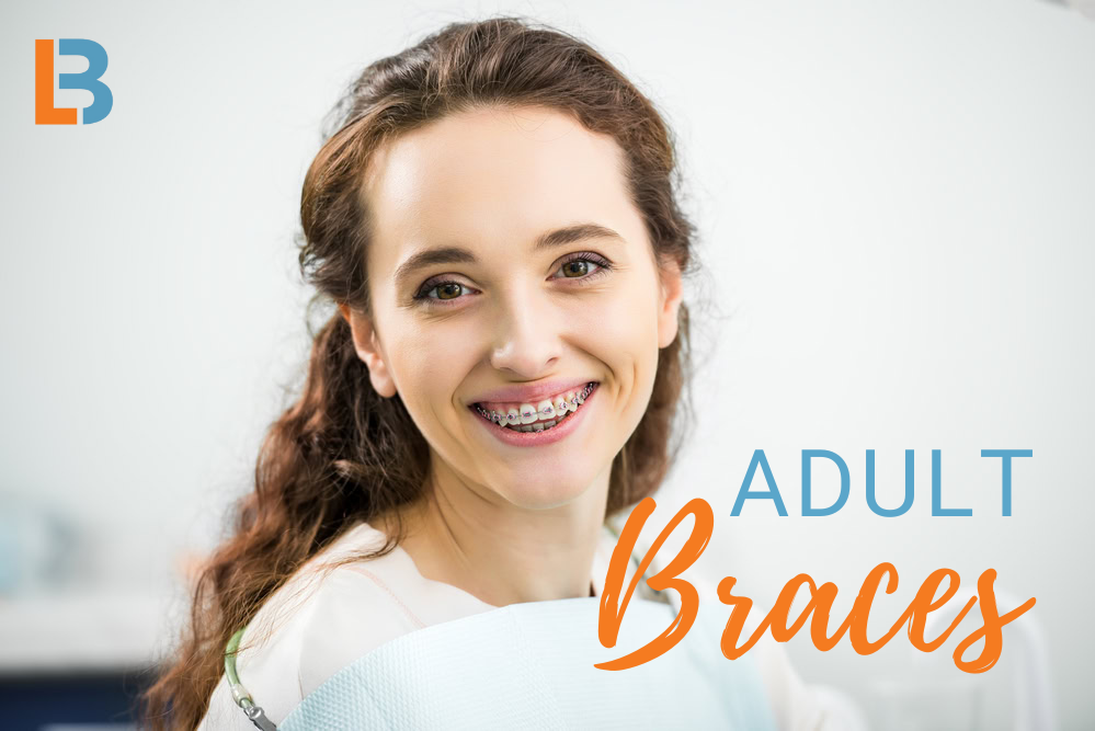 Woman smiling with adult orthodontics at Longmont Braces in Colorado.