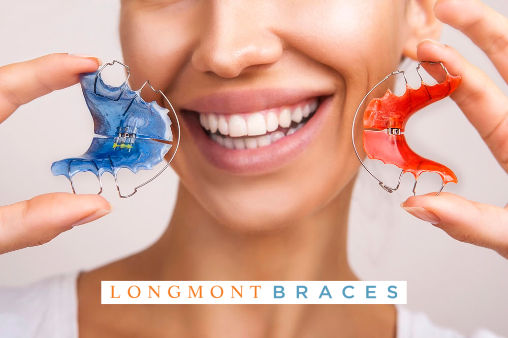 Woman holding an orange orthodontic retainer and a blue orthodontic retainer, Longmont Braces, Colorado